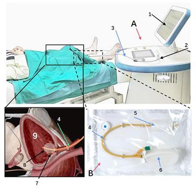 A Multi-Center, Randomized, Blind, Controlled Clinical Trial of the Safety and Efficacy of Micro Radio Frequency Therapy System for the Treatment of Overactive Bladder